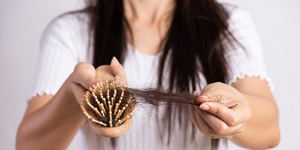 Frau mit Haarausfall