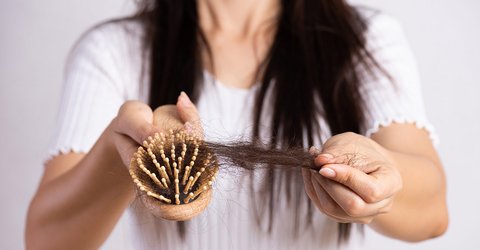 Frau mit Haarausfall