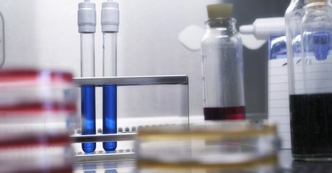 Labor bei Pflüger